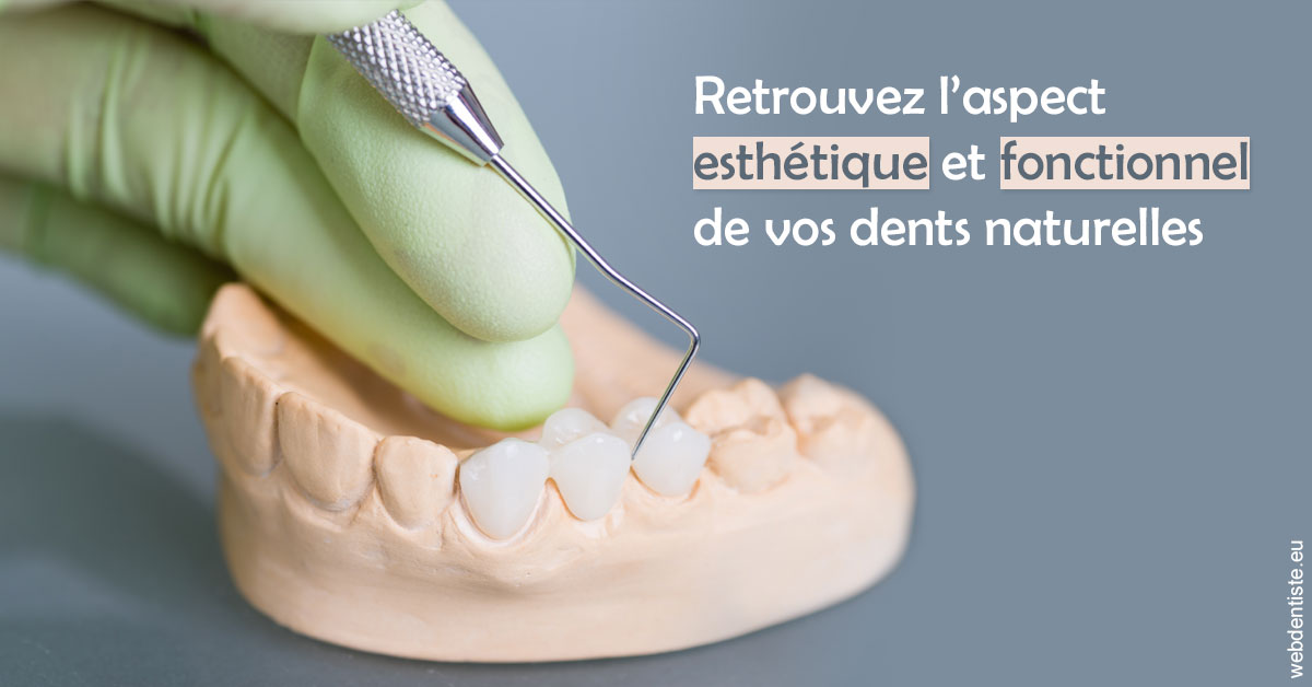 https://www.dr-heitz-dybski.fr/Restaurations dentaires 1
