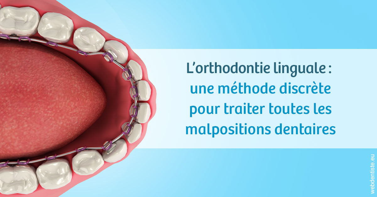 https://www.dr-heitz-dybski.fr/L'orthodontie linguale 1