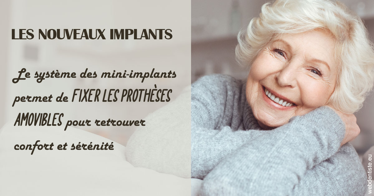 https://www.dr-heitz-dybski.fr/Les nouveaux implants 1