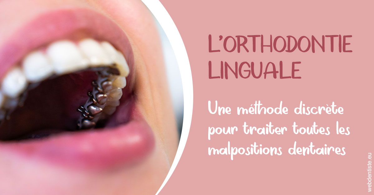 https://www.dr-heitz-dybski.fr/L'orthodontie linguale 2