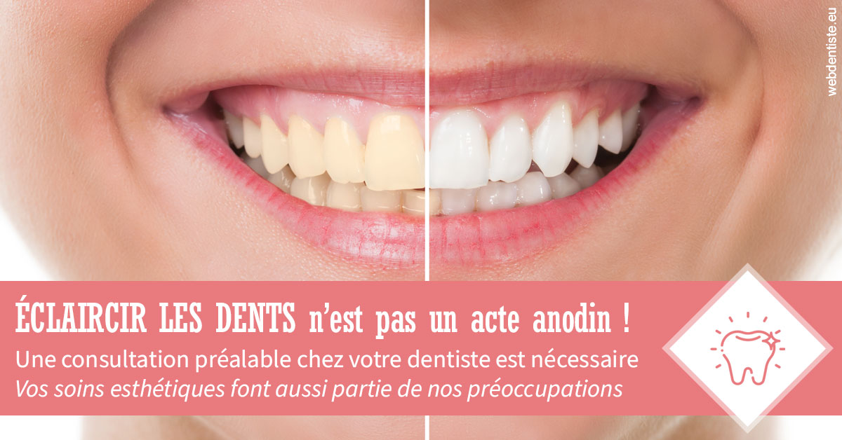 https://www.dr-heitz-dybski.fr/Eclaircir les dents 1