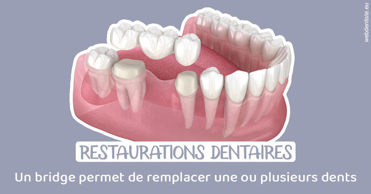 https://www.dr-heitz-dybski.fr/Bridge remplacer dents 1