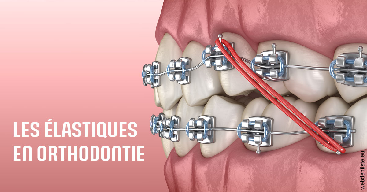 https://www.dr-heitz-dybski.fr/Elastiques orthodontie 2
